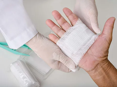 Wundmanagement einer verletzten Hand